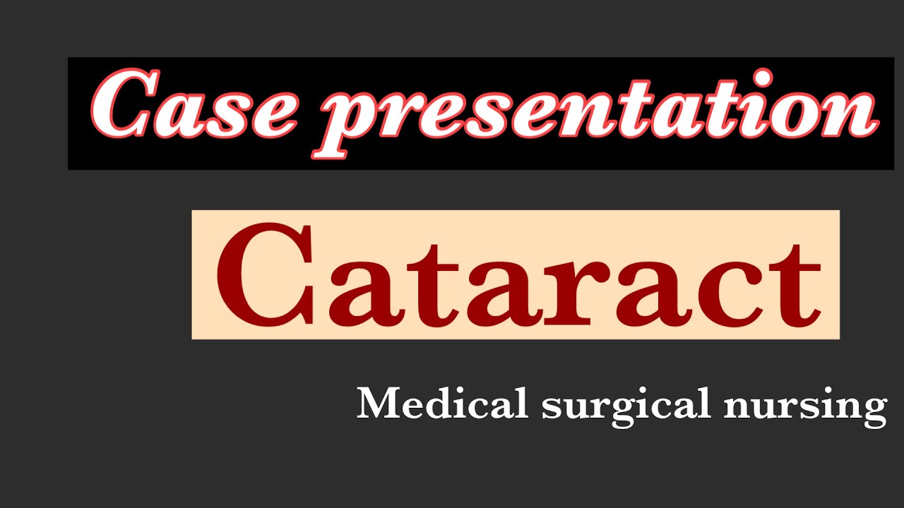Case presentation on cataract - YouTube