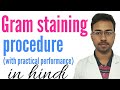 Gram staining procedure in hindi  gram staining of bacteria  staining technique in microbiology