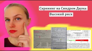 Скрининг на синдром Дауна: PAPP-A, βhCG, толщина воротникового пространства, кость носа, УЗИ-маркеры