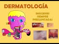 Dermatología 2021 (Video-clase Con Imágenes Más Preguntadas)