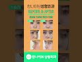 오똑한 콧대와 세련된 코끝! 코성형 수술전후 💗 I 한나이브성형외과 #shorts