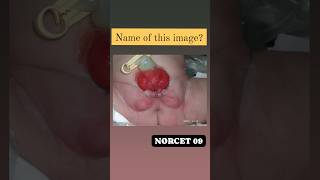 NORCET EXAM PYQ IMAGES #aiims #rml #staffnurse #shortvideo