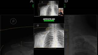 Download Lagu SHOULDER X-Ray Critique (Case 5) MP3