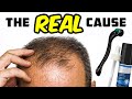 The REAL Cause Of Hair Loss And How To Prevent It