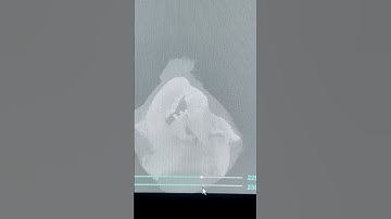 Volumetric Rendering of Dental CT Scan in Unity3d | C# tutorial | #MRI #unity