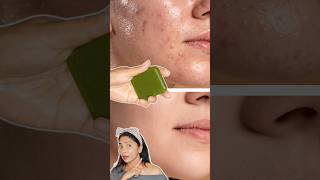 Summer Soap For Clear Skin-Neem Soap-Remove Bumps, Pimples, Whiteheads in 7 Days #homemade #diy