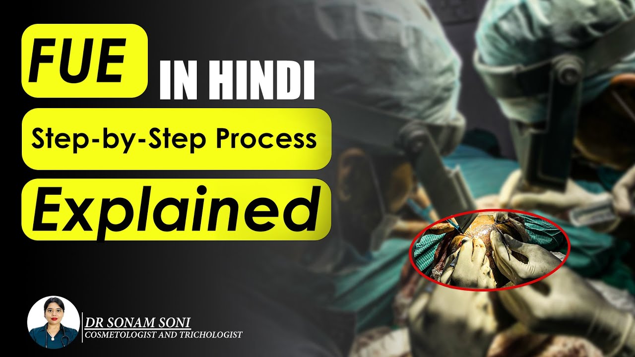 Full ( FUE ) Hair Transplant Surgery Explained" | By - DR SONAM SONI