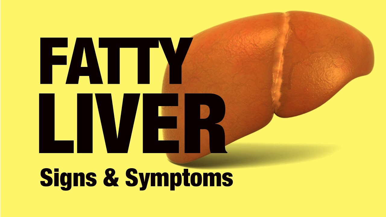 Fatty Liver Signs And Symptoms Fatty Liver Signs And Symptoms
