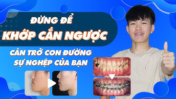 Niềng Răng Khớp Cắn Ngược | Đừng Để Khớp Cắn Ngược Cản Trở Con Đường Của Bạn | Nam Bùi Vinalign