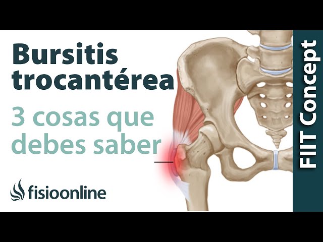 De rodilla fisioterapia bursitis