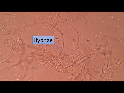 Video: Perbezaan Antara Hyphae Dan Pseudohyphae