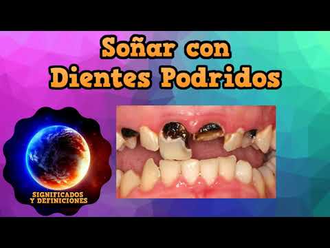 Video: ¿Por qué soñar con dientes podridos en tu boca?