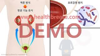 [시연용] g0032aako_신경인성방광 환자의 배뇨일지 작성과 방광관리 안내