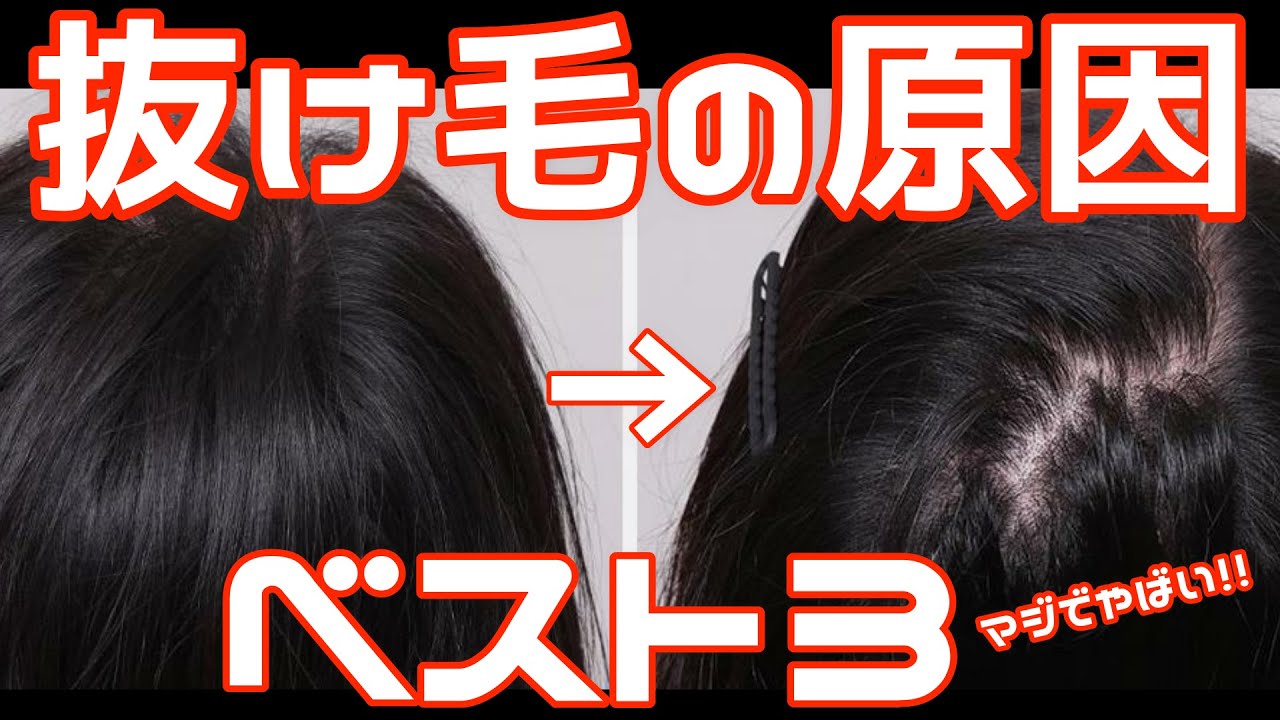 【抜け毛】 髪の毛が抜ける原因ベスト3！！抜けなくなる方法教えます！！ - YouTube