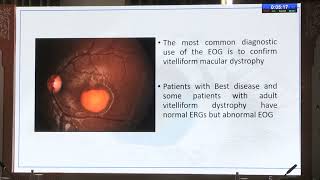 AIOC2026   IC232 Tips on Eog Dr Bharti Kashyap