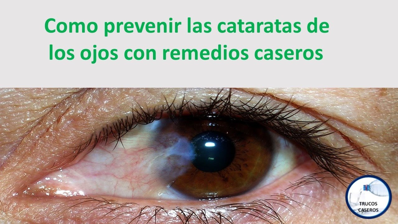Qu son las Cataratas