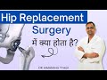 Hip Replacement Surgery  में क्या होता है? | Types, Procedure और Benefits | Dr. Himanshu Tyagi