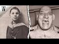 The Haunting STRANGE CASE of Maurice Tillet