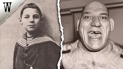 The Haunting STRANGE CASE of Maurice Tillet