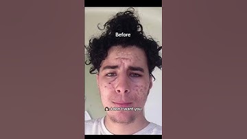 My Transformation..  #glowup #looksmax #looksmaxing