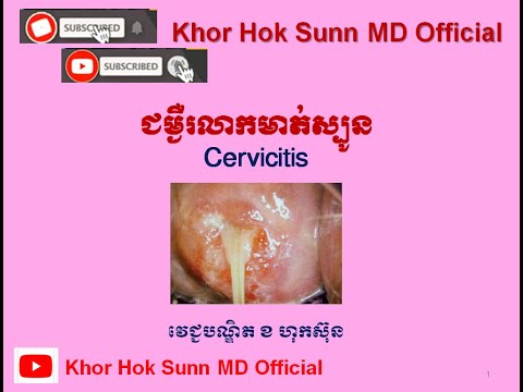 អ្វីទៅជាជំងឺរលាកមាត់ស្បូន?/ What is Cervicitis ? l Khor Hok Sunn MD Official