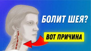 Болит шея. Почему? Как Лечить? | Остеопат Марина Просветина