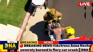 🔴Breaking News!!!Actress Anne Heche severely burned in fiery car crashDNA|