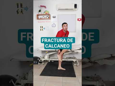 Fracturé el calcaneo fractura del pie #fracturas #calcaneo #fracturadetobillo #fisioterapia