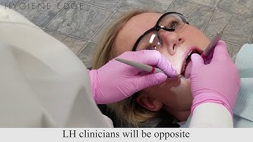 Klokposities die u kunt gebruiken tijdens het schalen