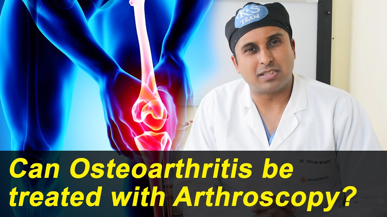 Can Osteoarthritis be Treated with Arthroscopy? 🔰Treatment for Osteoarthritis Arthroscopy Advantages