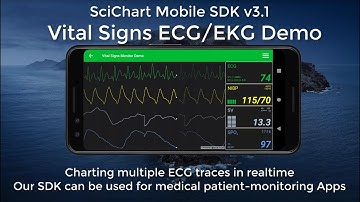 SciChart Mobile SDK v3.1 Vital Signs Patient Monitor & Audio Spectrum Analyzer