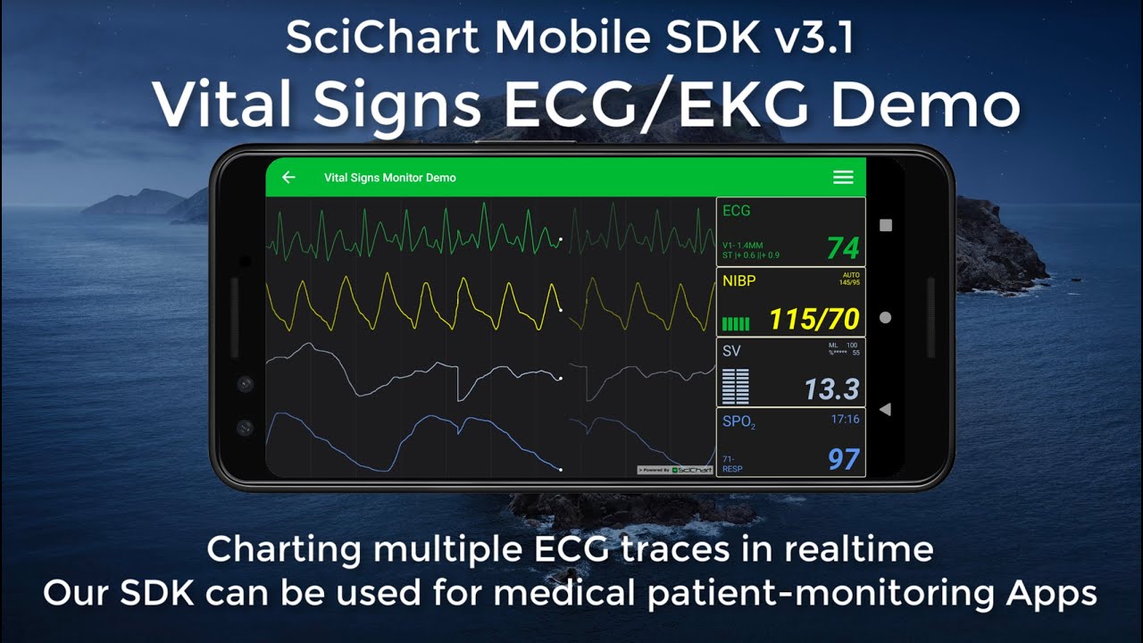 Mobile SDK v3.1: Real-Time ECG Monitor & Audio Analyzer - SciChart