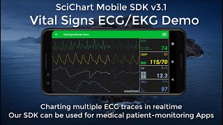Mobile SDK v3.1: Real-Time ECG Monitor & Audio Analyzer - SciChart screenshot 2