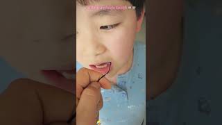 Pulling a child's tooth? 🦷 That's crazy! 😂#funny#fyp#prank#scary#foryou