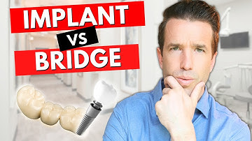Dental Implants vs Bridges for a Missing Tooth