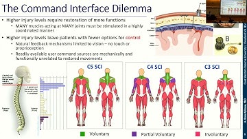 GT Neuro | Talk by Bolu Ajiboye