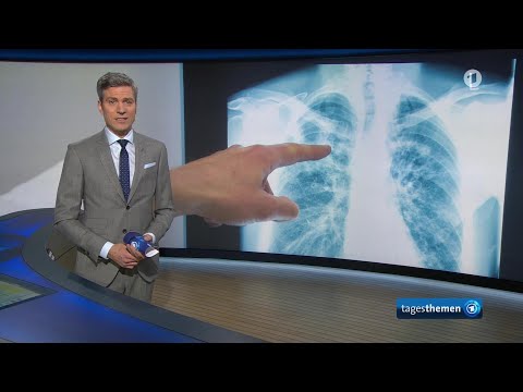 tagesthemen 23:00 Uhr, 09.02.2026

tagesthemen 23:00 Uhr

Steigende Krankenkassen-Beitr&auml;ge: Welches Reform-Modell Chancen auf Umsetzung hat, Gewalt gegen Zugbegleiter: Was Angestellte der Bahn t&auml;glich erleben, Epstein-Files: In Gro&szlig;britannien w&auml;chst der Druck auf Premier Starmer, Mega-Ereignis Superbowl: Bad Bunny feiert Lateinamerika und ver&auml;rgert Trump, Weitere Meldungen im &Uuml;berblick, #mittendrin in Ziegendorf: Der Fellmacher, Das Wetter

Die Beitr&auml;ge zum "Super Bowl" und den "Olympischen Spielen" d&uuml;rfen auf tagesschau.de aus rechtlichen Gr&uuml;nden nicht gezeigt werden.

#tagesthemen #2300 #Uhr #09022026