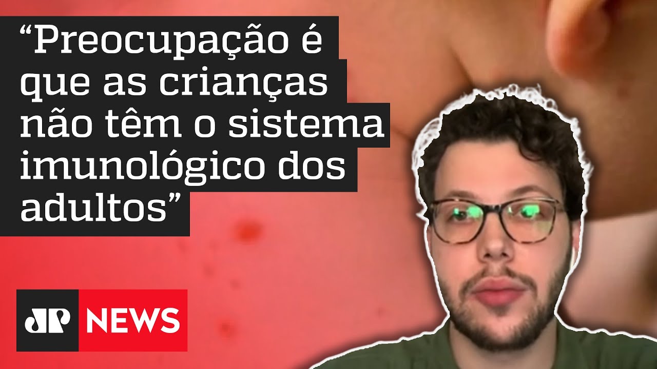 Quais os riscos da contaminação infantil da varíola dos macacos? Pediatra responde