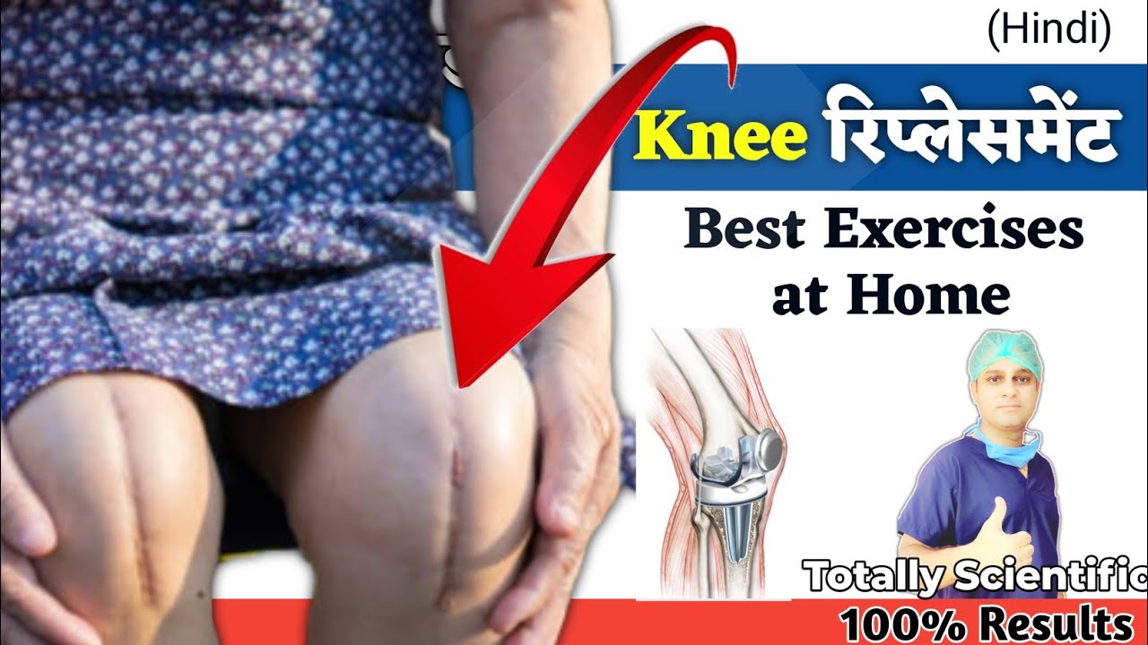 Ghutno ke operation ke baad ke Exercises || PHYSIOTHERAPY after Knee Replacement || Hindi
