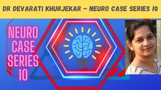 Neuroradiology Case 10 Dr Devrathi Khurjekar 1 Yr Old Child Mri Brain