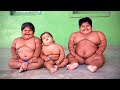 The Most Overweight Kids in The World