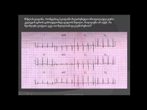 გულის შუილი / T კბილების ინვერსია / sinusuri taqikardia / ელექტროკარდიოგრამის წაკითხვა