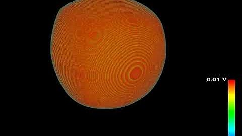 Computational Modeling of Cardiac Arrhythmia in 3D