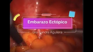 Sandra Aguilera Cervantes-15