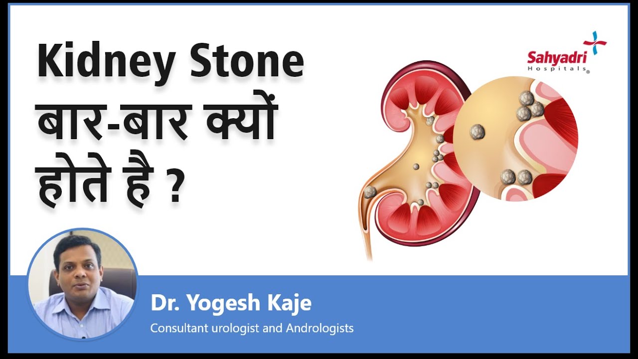 Kidney Stone बार-बार क्यों होते है? |Causes of Kidney Stone in Hindi| Dr Yogesh Kaje | Sahyadri