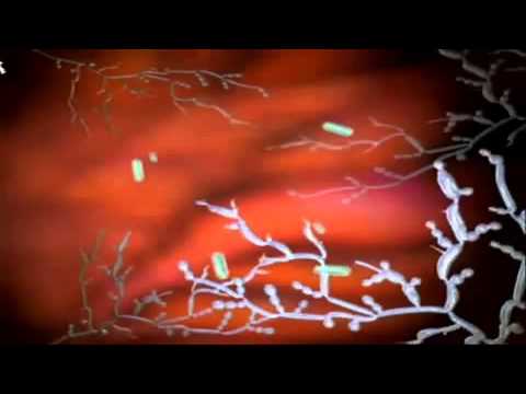 Cure For Yeast Infection - Vaginal Yeast Infections - YouTube