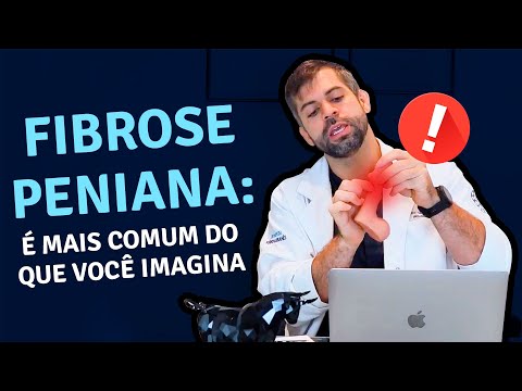 Fibrose Peniana  é Mais Comum do que Você Imagina! | Dr. Marco Túlio Cavalcanti - Andrologista