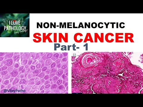 SKIN CANCER: Non Melanocytic: Part 1- Anatomy