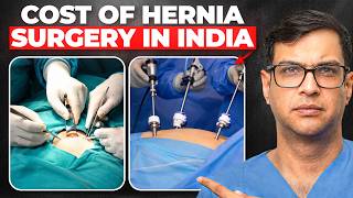 Hernia Surgery Decoded: Types, Cost, Recovery and What to Expect