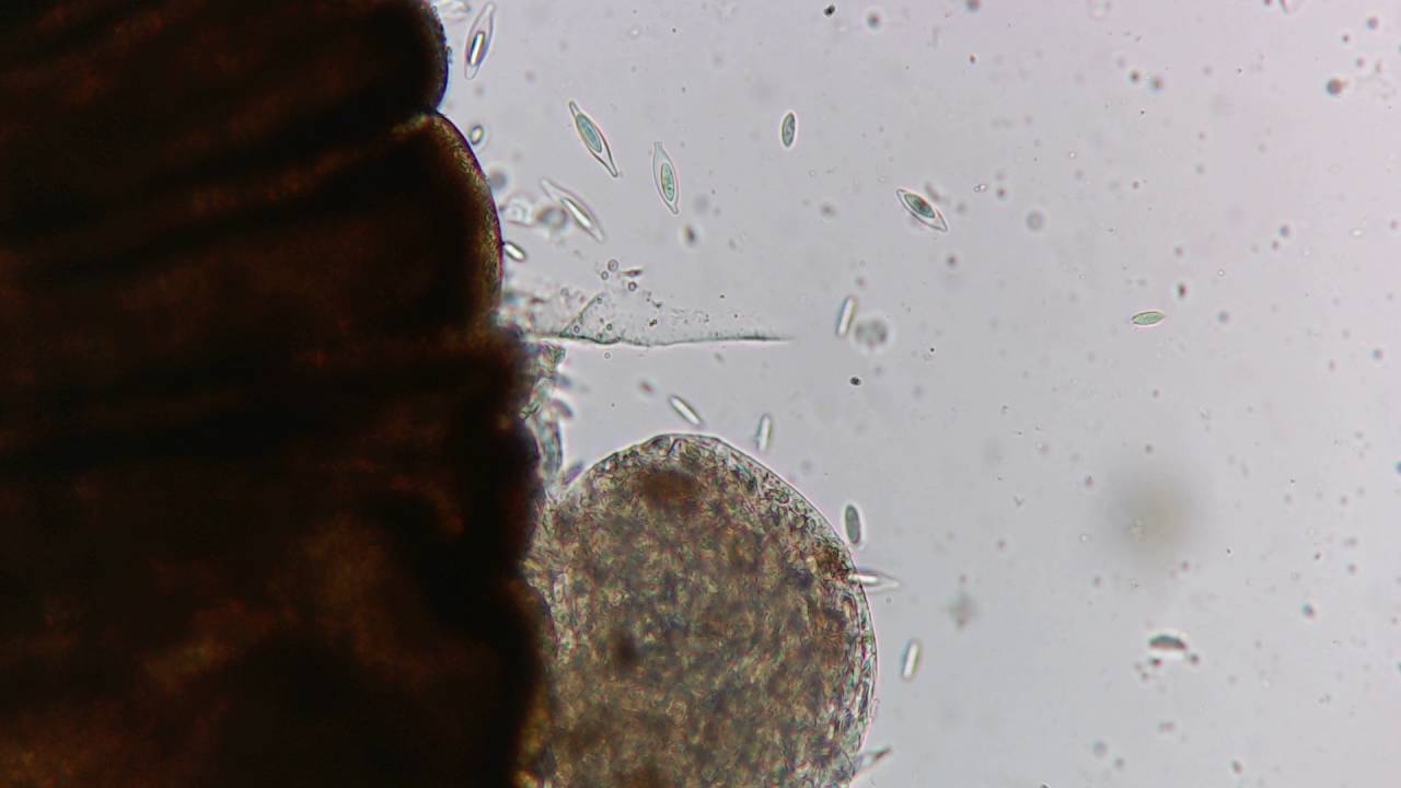 Яйца скребня из monodactylus argenteus 2